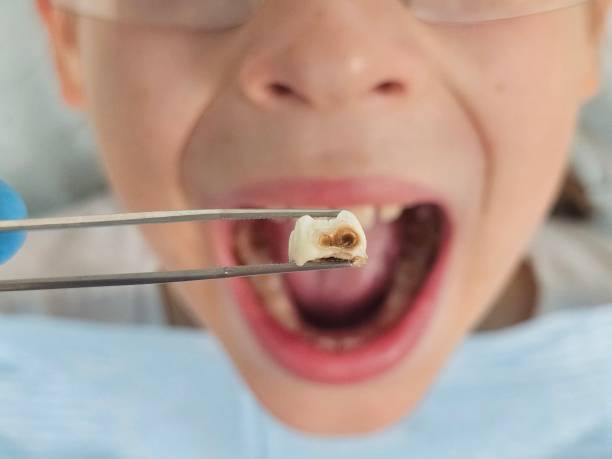 Best Walk-In Emergency Dentist in Tonkawa, OK